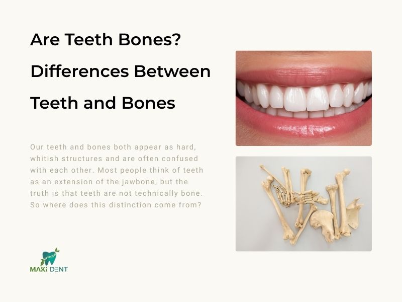 Are Teeth Bones?