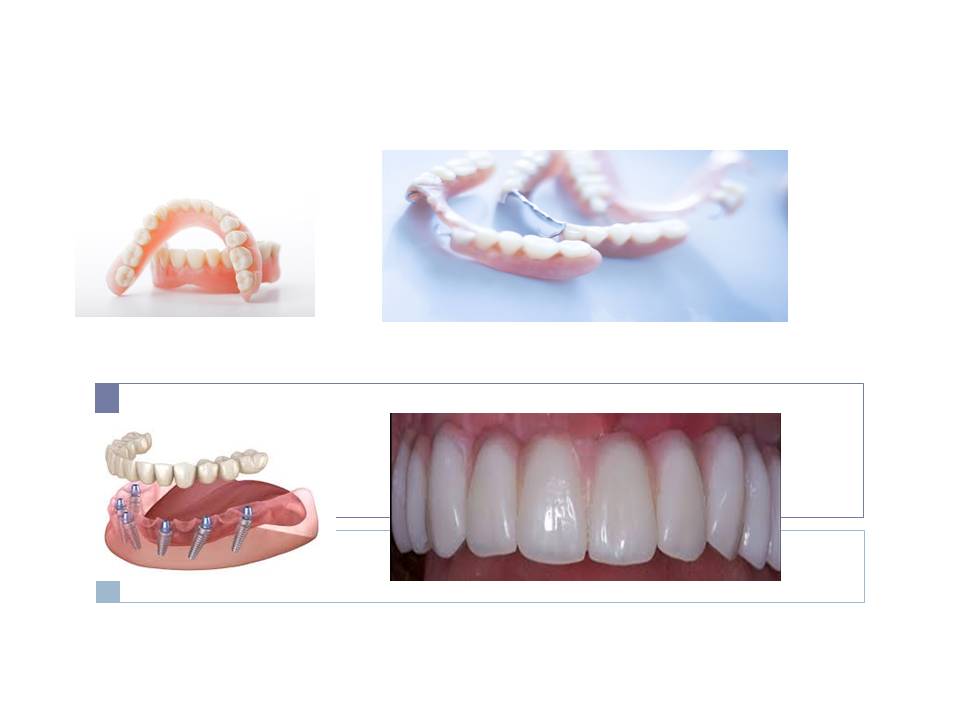 What types of dentures can be used for receding gums?