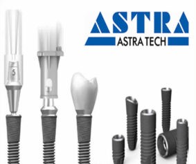 Astra Tech Implant