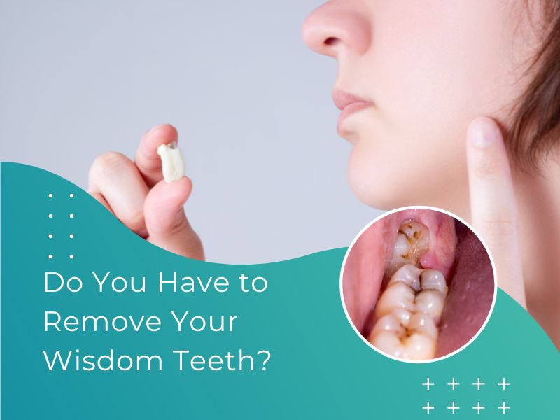 Can Dental Implants Fall Out? Can Dental Implants Fall Out?