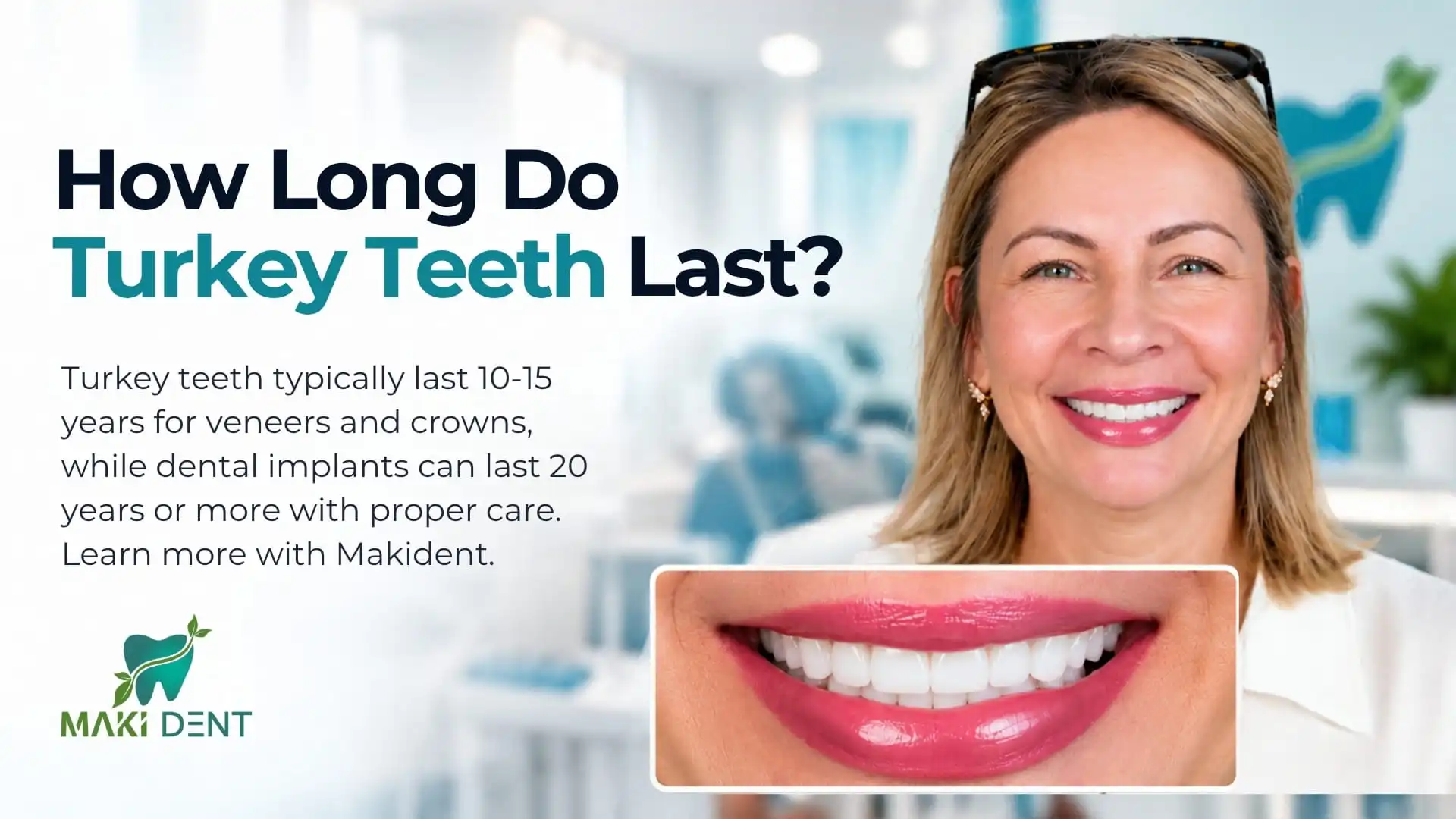 How Long Do Turkey Teeth Last? Veneers, Crowns and Implants | Makident Antalya