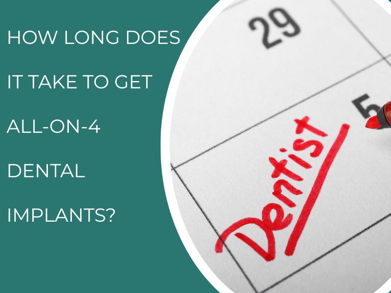 How Long Does It Take To Get All-On-4 Dental Implants?