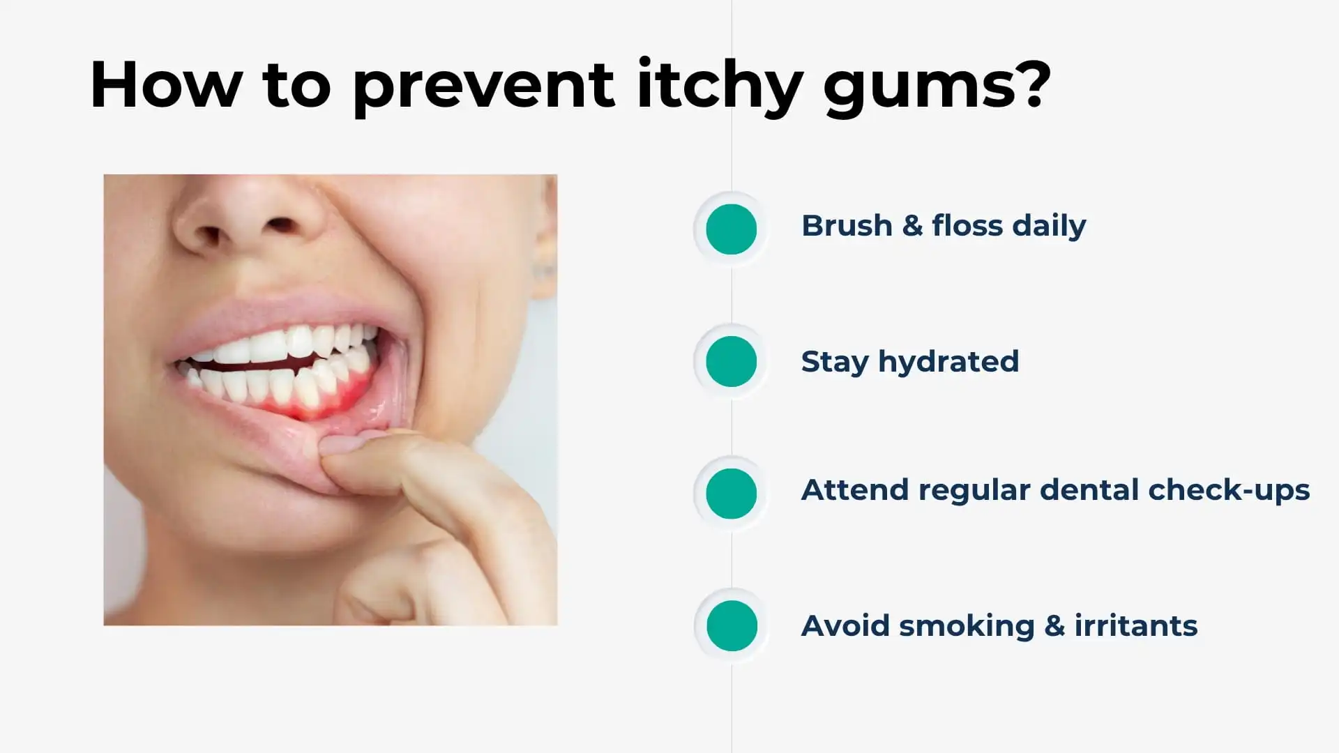 How to prevent itchy gums? Antalya, Turkey 