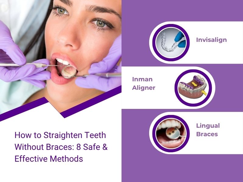 How to Straighten Teeth Without Braces