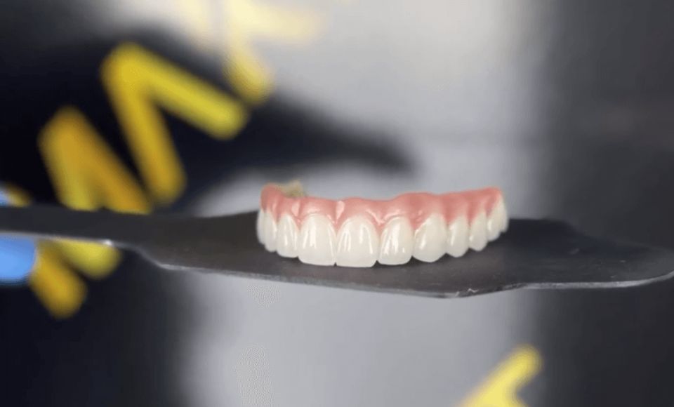 all on 6 dental implants permanent prosthesis